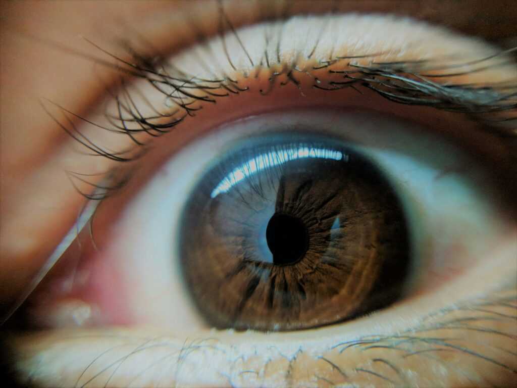 Astigmatism vs. Normal Vision: What It Looks Like